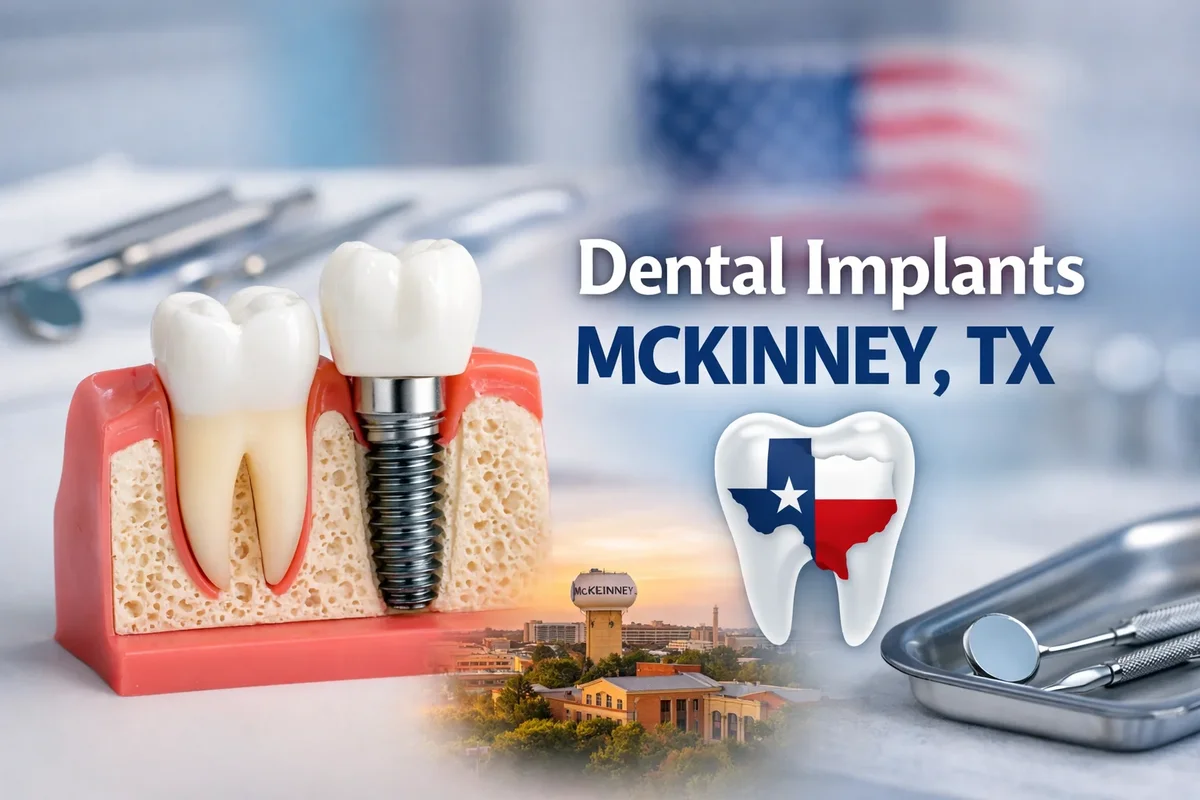 Dental Implants McKinney TX: Complete Guide for Patients 4 dental implants mckinney tx