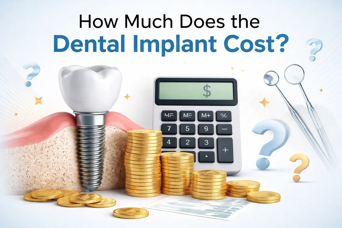 How Much Does the Dental Implant Cost? Complete 2026 Guide 5 how much does the dental implant cost