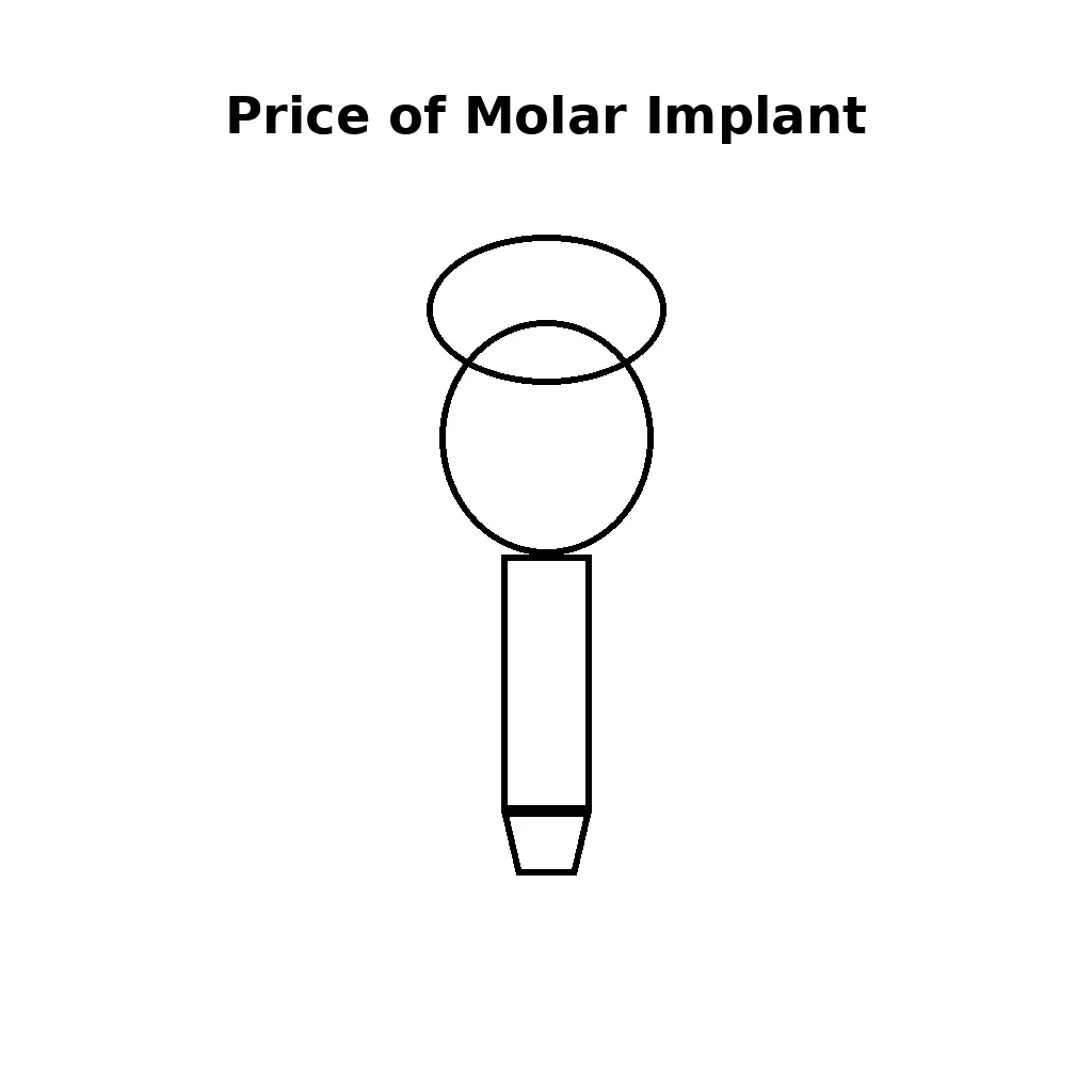 Price of Molar Implant: Complete Guide to Costs, Factors, and Value 4 price of molar implant