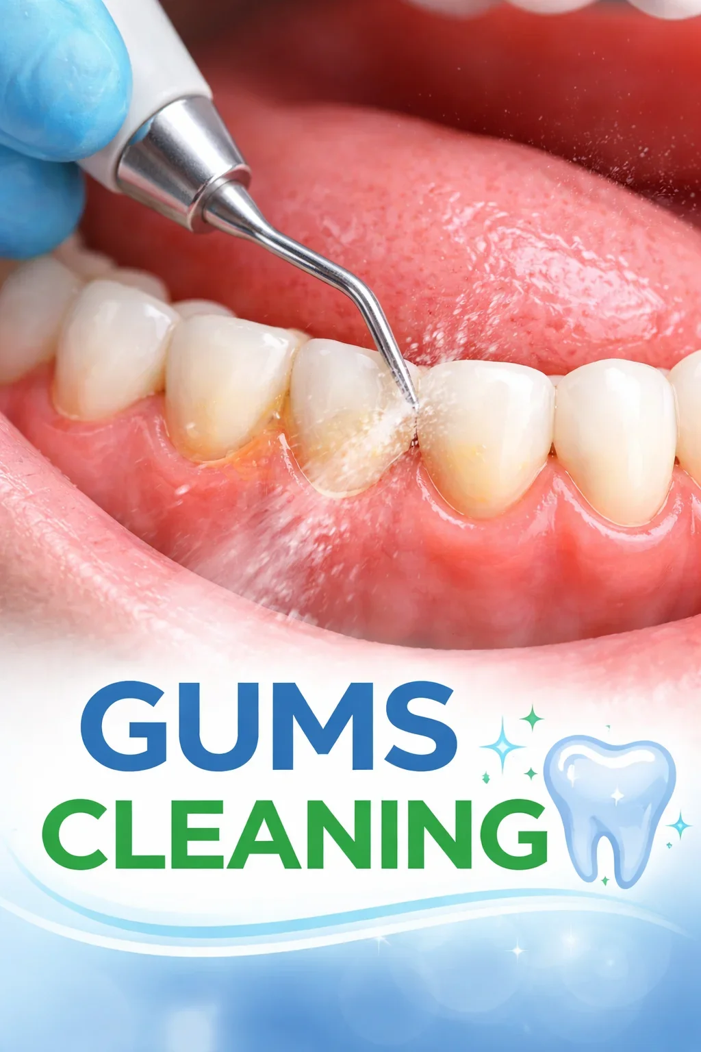 Gums Cleaning: Complete Guide for Healthy Smiles 5 gums cleaning
