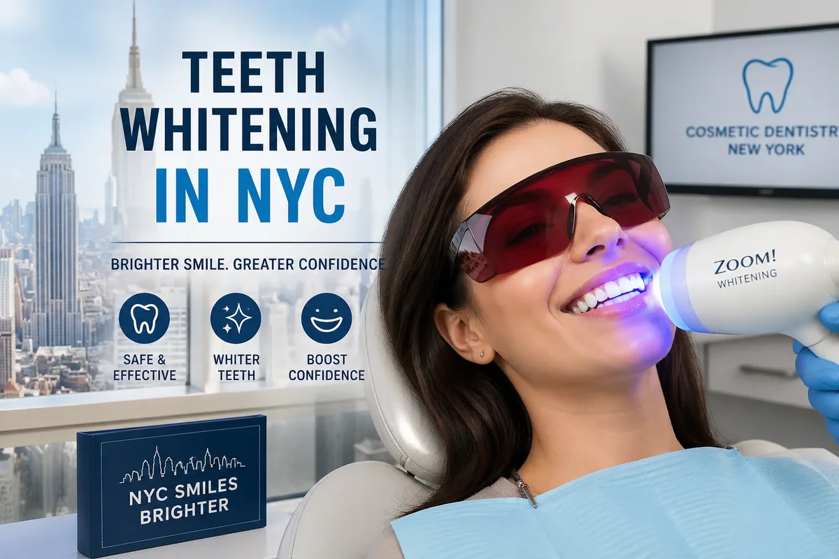 Teeth Whitening in NYC: 9 Expert Tips for a Brighter Smile 5 teeth whitening in nyc