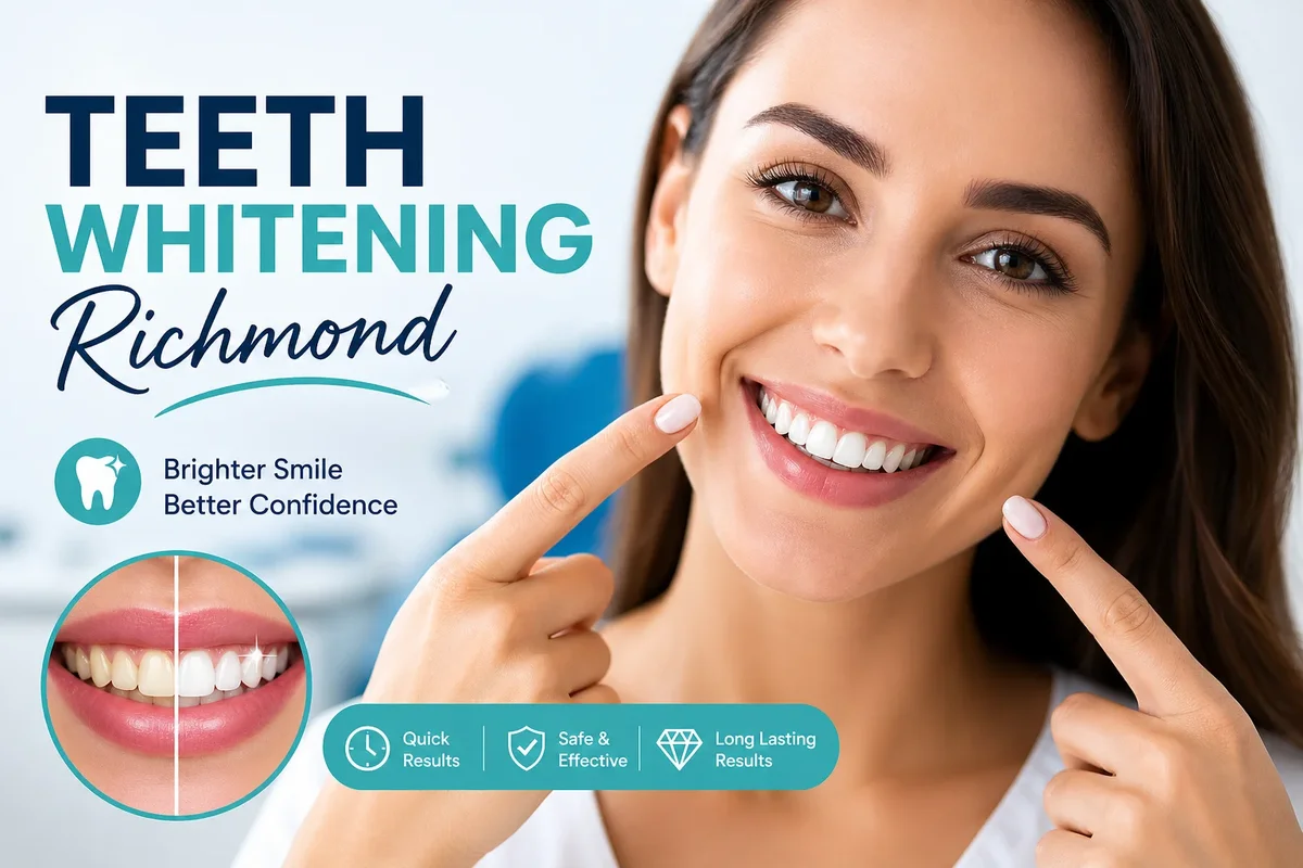Teeth Whitening Richmond: Complete Guide to a Brighter Smile 5 teeth whitening richmond