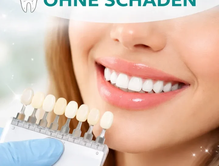 zahnaufhellung ohne schäden: Was Sie wirklich wissen müssen 20 zahnaufhellung ohne schäden
