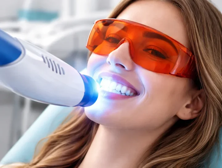 Zahnbleaching mit Licht: Alles, was Sie wissen müssen 12 zahnbleaching mit licht