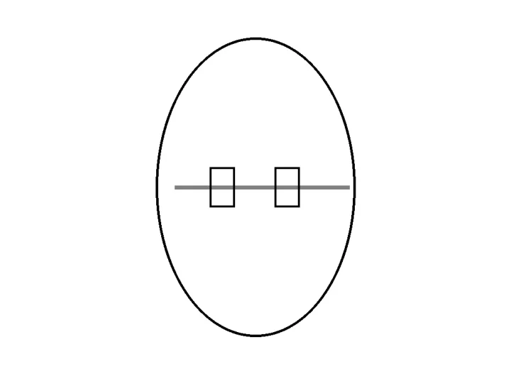 zähne mit zahnspange richtig putzen