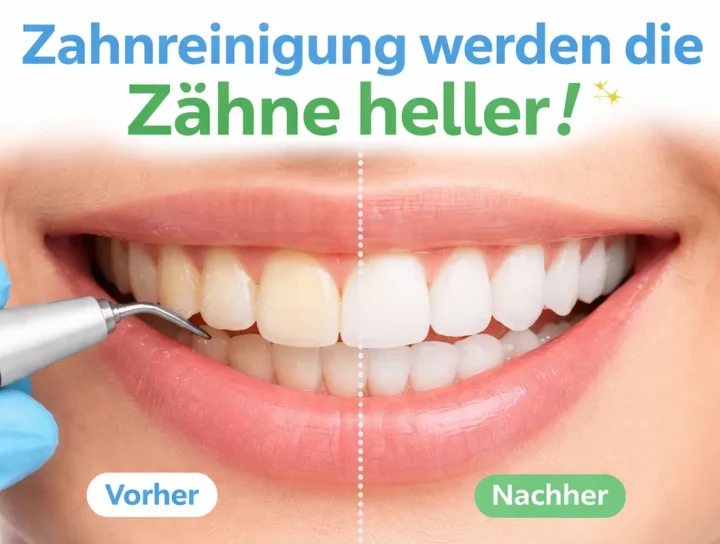 zahnreinigung werden die zähne heller – Was Sie wirklich wissen sollten 8 zahnreinigung werden die zähne heller