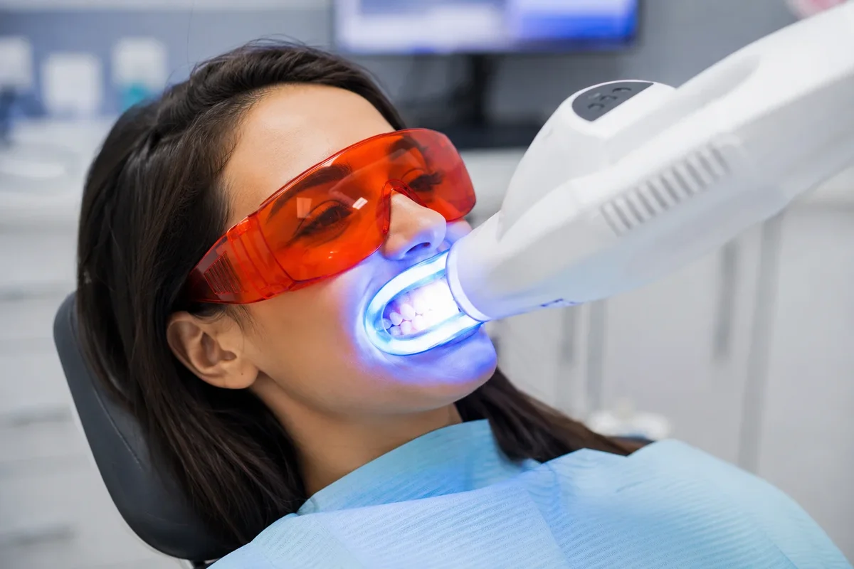 Blanchiment Pro : Guide Complet pour un Sourire Plus Blanc 5 blanchiment pro