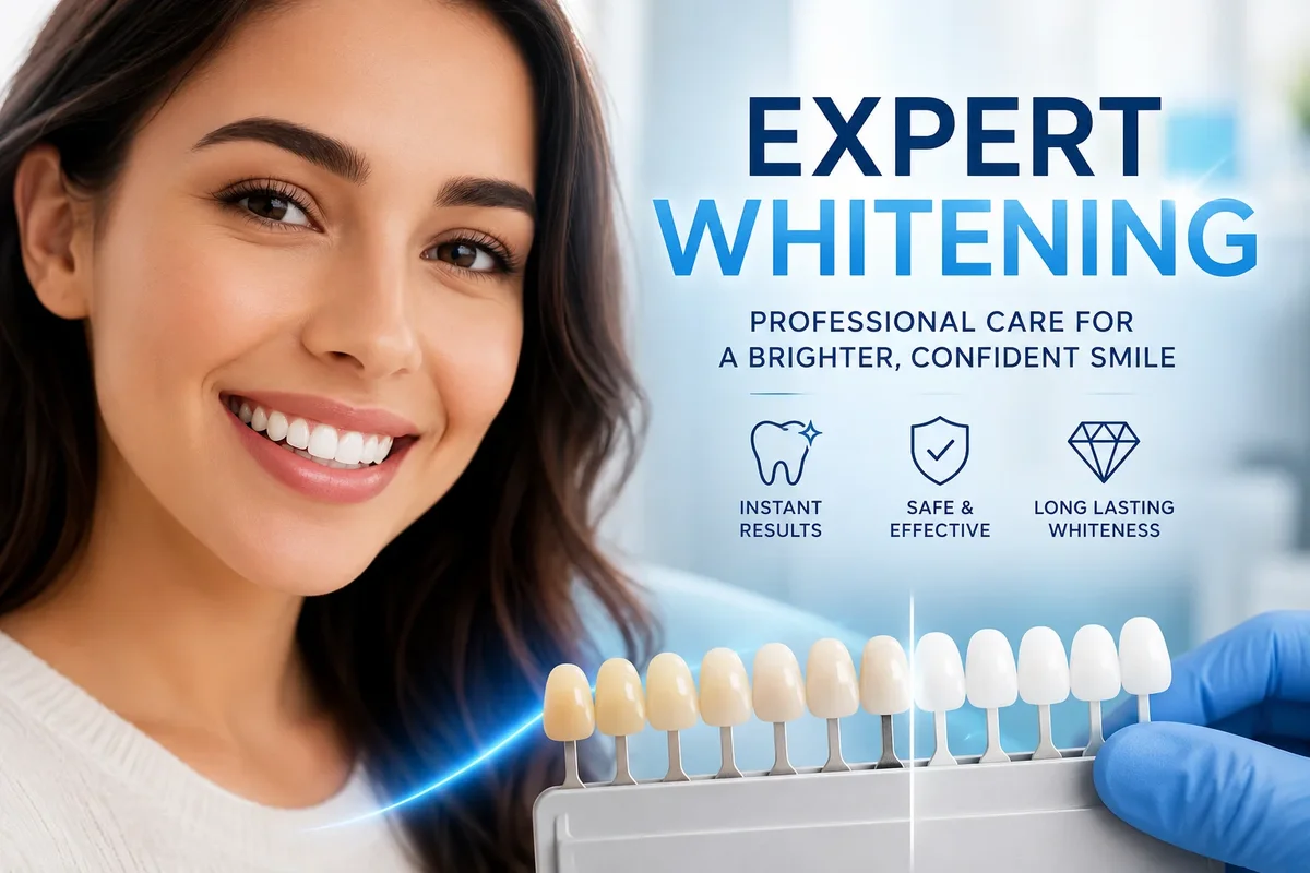 Expert Whitening Treatments for a Radiant Smile 5 expert whitening