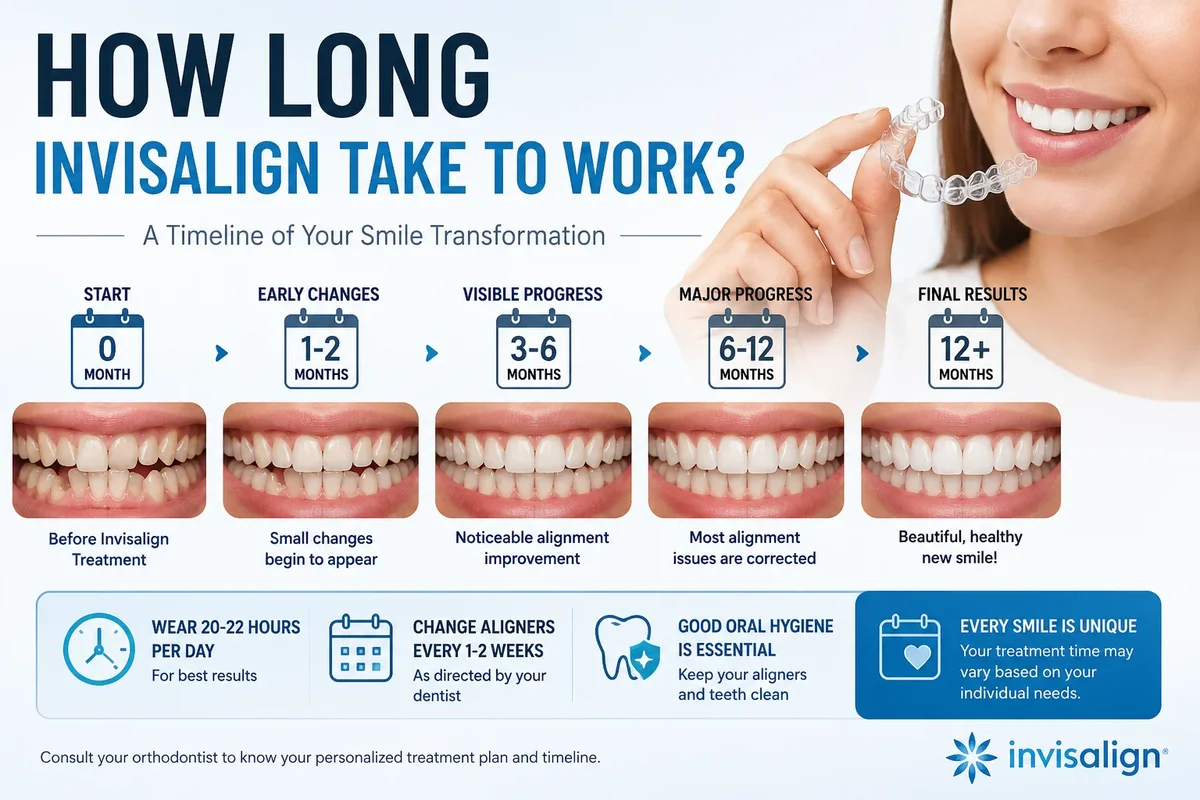 How Long Invisalign Take to Work for a Straighter Smile 5 how long invisalign take to work