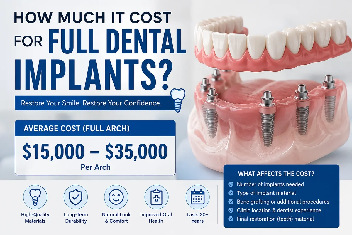 How Much It Cost for Full Dental Implants 5 how much it cost for full dental implants