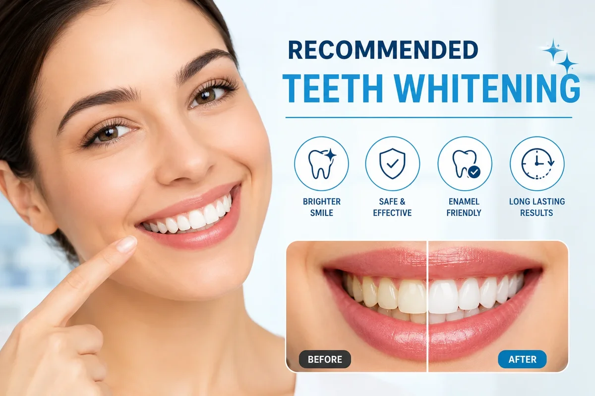Recommended Teeth Whitening: Safe Ways to Brighten Your Smile 5 recommended teeth whitening