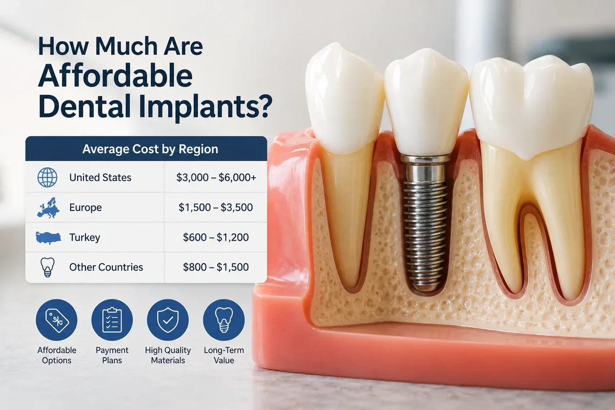 How Much Are Affordable Dental Implants? 5 how much are affordable dental implants
