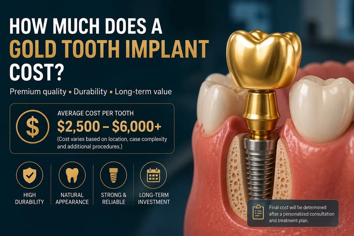 How Much Does a Gold Tooth Implant Cost? Quick Answer and What It Means for You 5 how much does a gold tooth implant cost