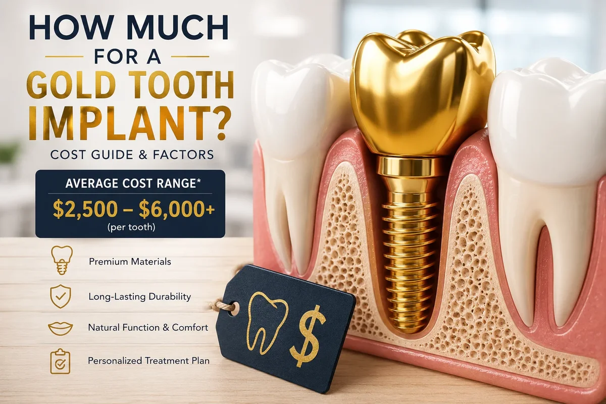 How Much for a Gold Tooth Implant? Quick Answer and What It Means for You 5 how much for a gold tooth implant