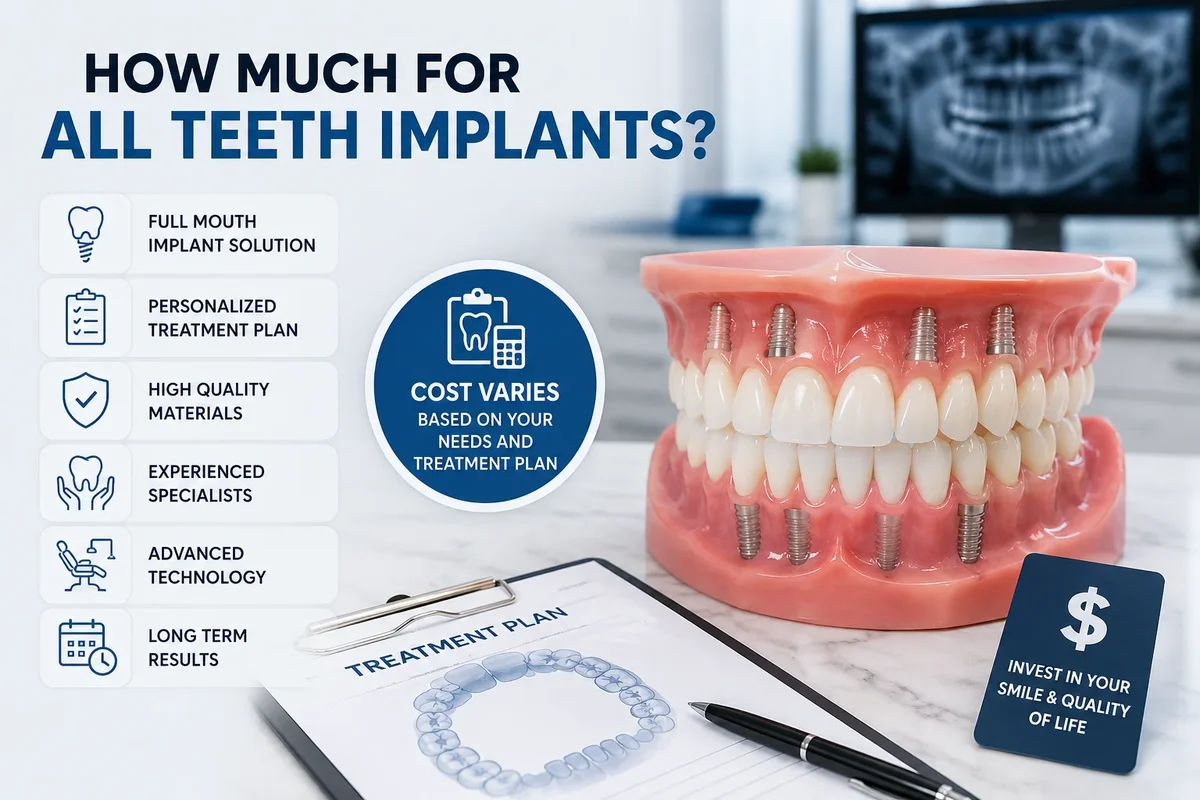 How Much for All Teeth Implants? A Quick Answer for Patients Considering Full-Mouth Restoration 5 how much for all teeth implants