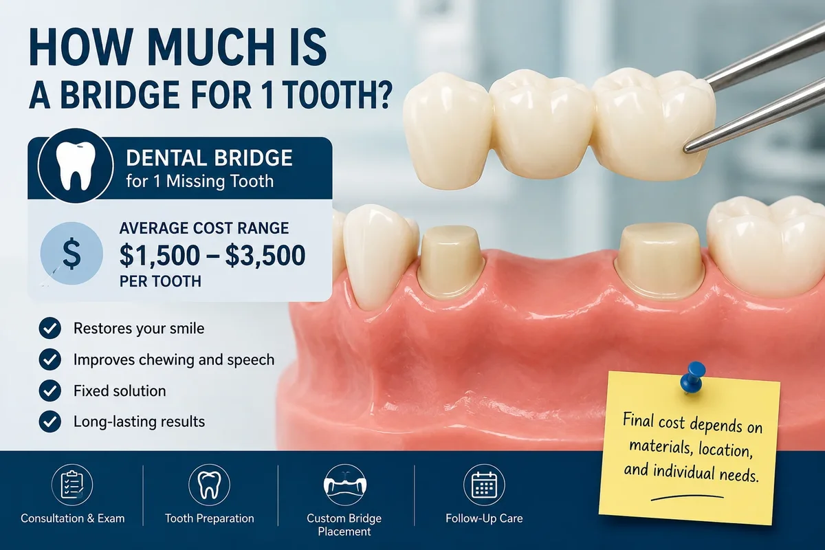 How Much Is a Bridge for 1 Tooth 5 how much is a bridge for 1 tooth