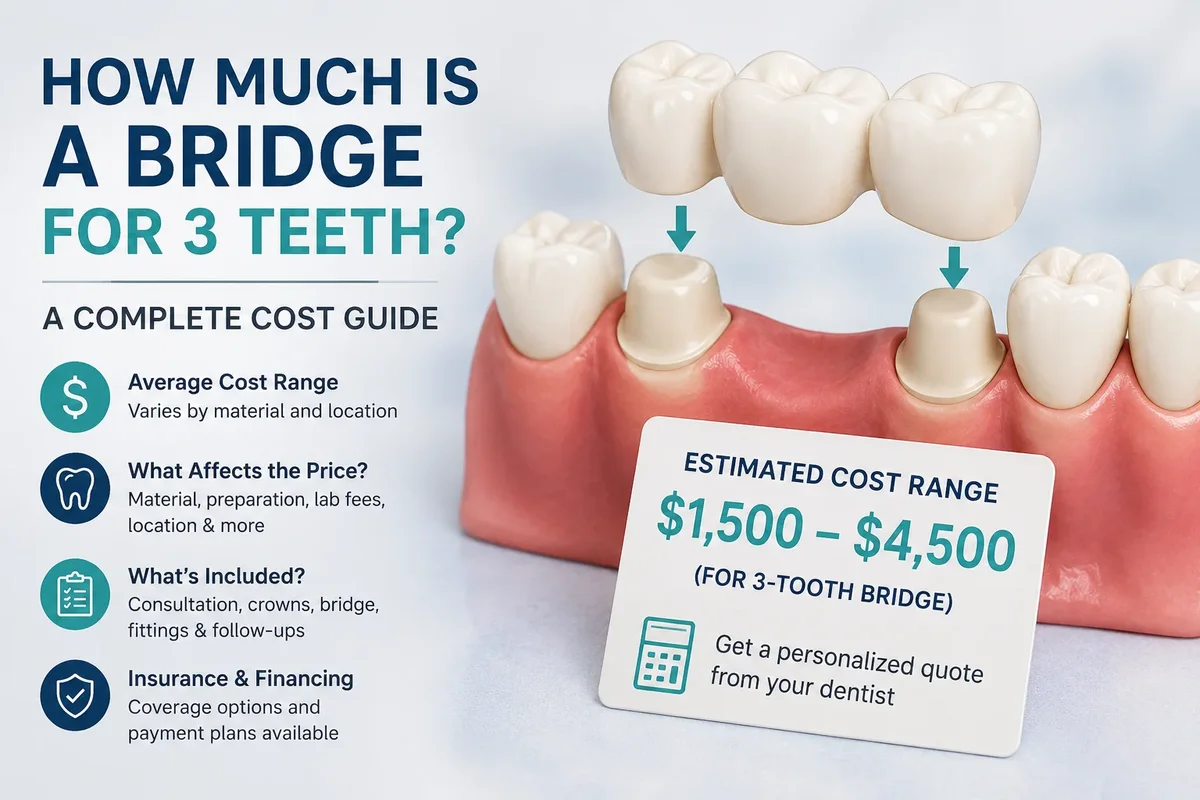How Much Is a Bridge for 3 Teeth? 5 how much is a bridge for 3 teeth