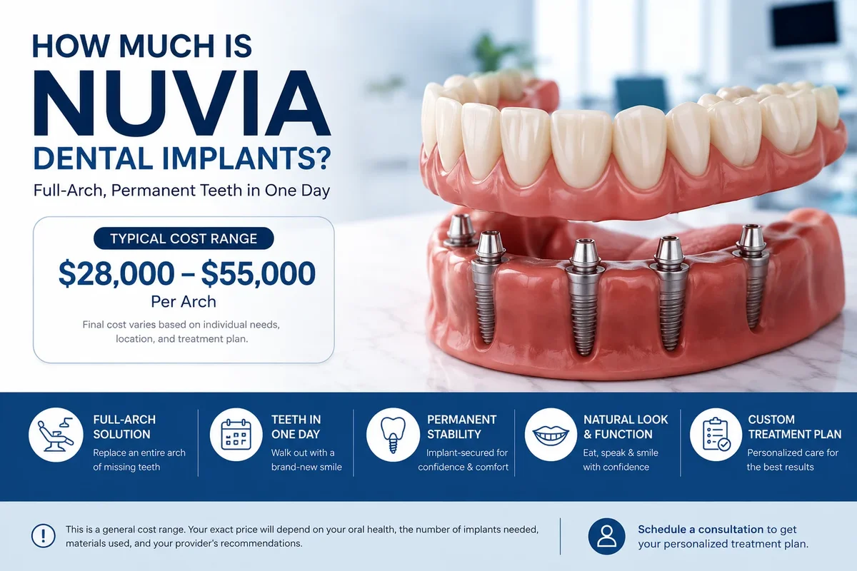 How Much Is Nuvia Dental Implants? 5 how much is nuvia dental implants