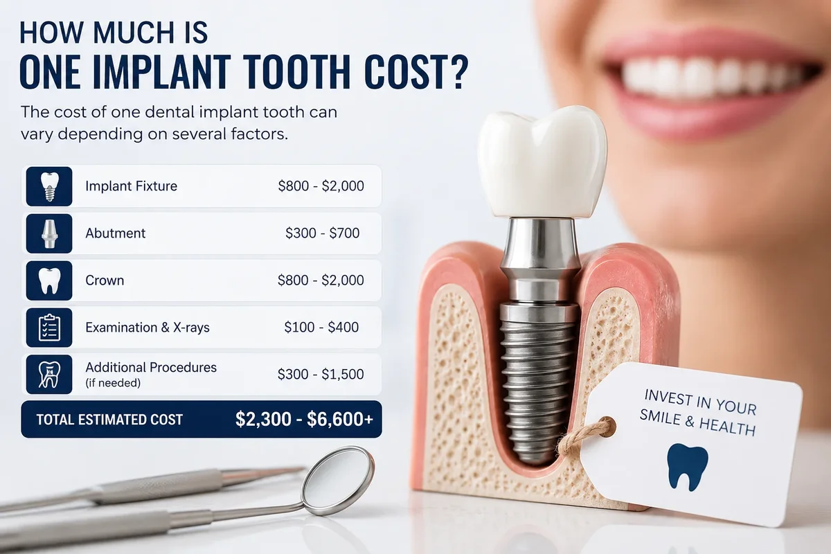 How Much Is One Implant Tooth Cost? 5 how much is one implant tooth cost