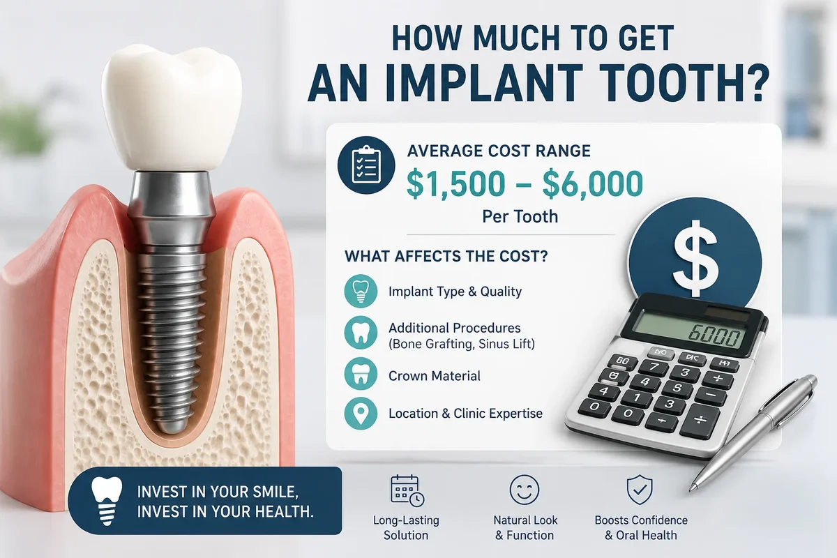 How Much to Get an Implant Tooth 5 how much to get an implant tooth