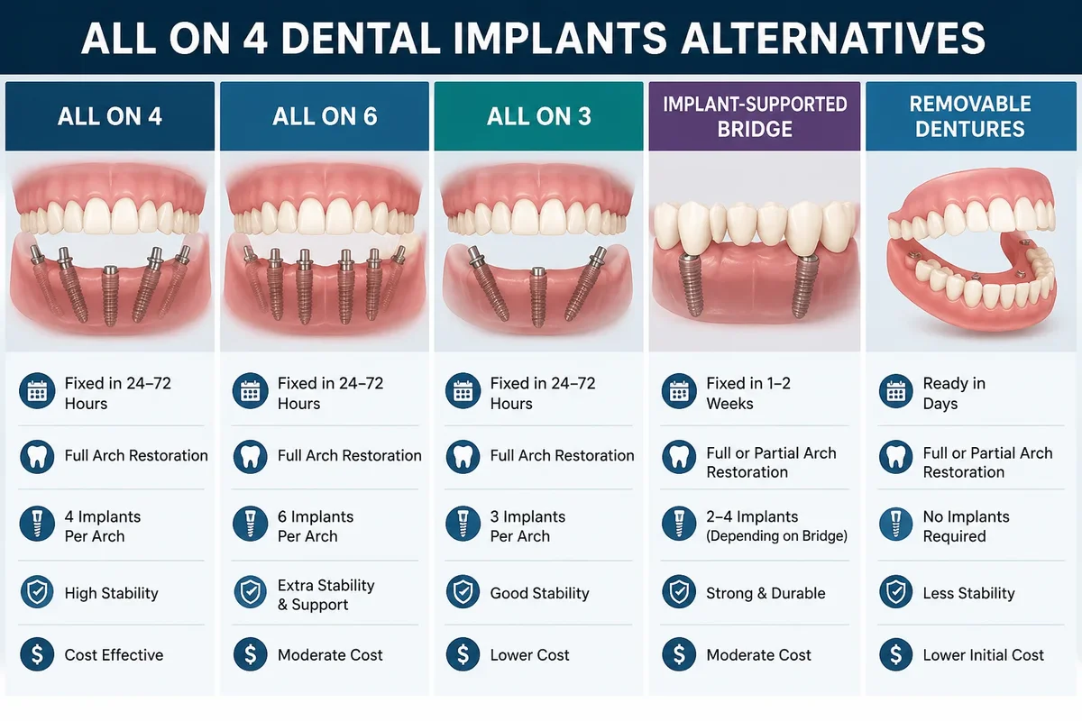 All on 4 Dental Implants Alternatives: How to Choose the Right Solution 5 all on 4 dental implants alternatives