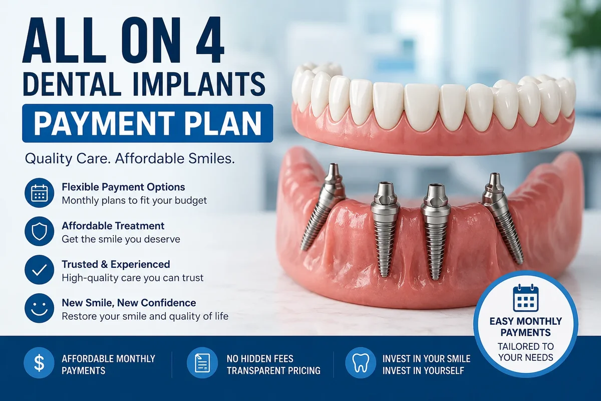 All on 4 Dental Implants Payment Plan: What You Need to Know Before You Decide 5 all on 4 dental implants payment plan
